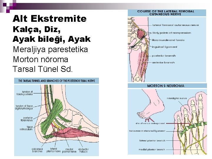 Alt Ekstremite Kalça, Diz, Ayak bileği, Ayak Meraljiya parestetika Morton nöroma Tarsal Tünel Sd.