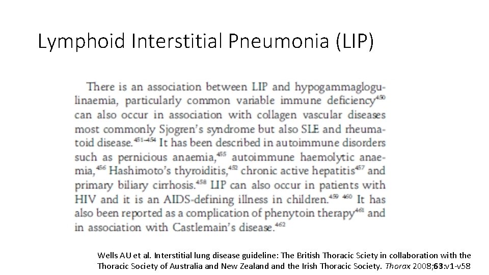 Lymphoid Interstitial Pneumonia (LIP) Wells AU et al. Interstitial lung disease guideline: The British