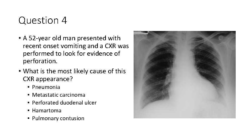 Question 4 • A 52 -year old man presented with recent onset vomiting and