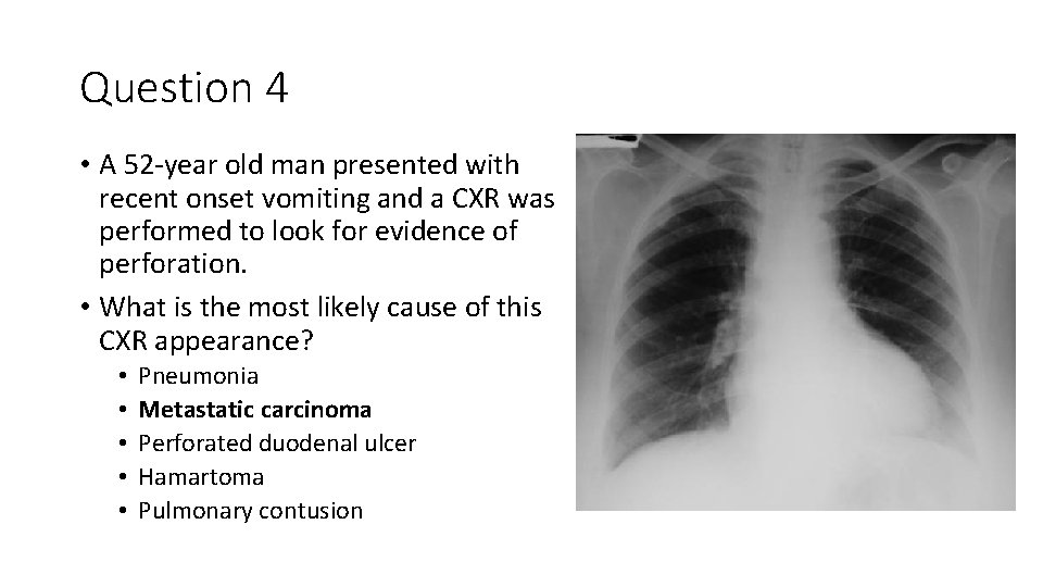 Question 4 • A 52 -year old man presented with recent onset vomiting and