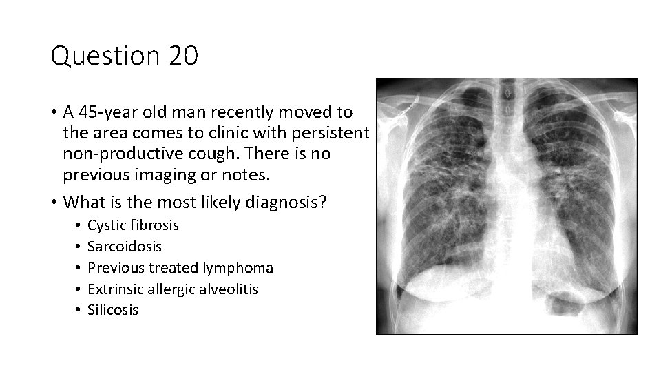 Question 20 • A 45 -year old man recently moved to the area comes