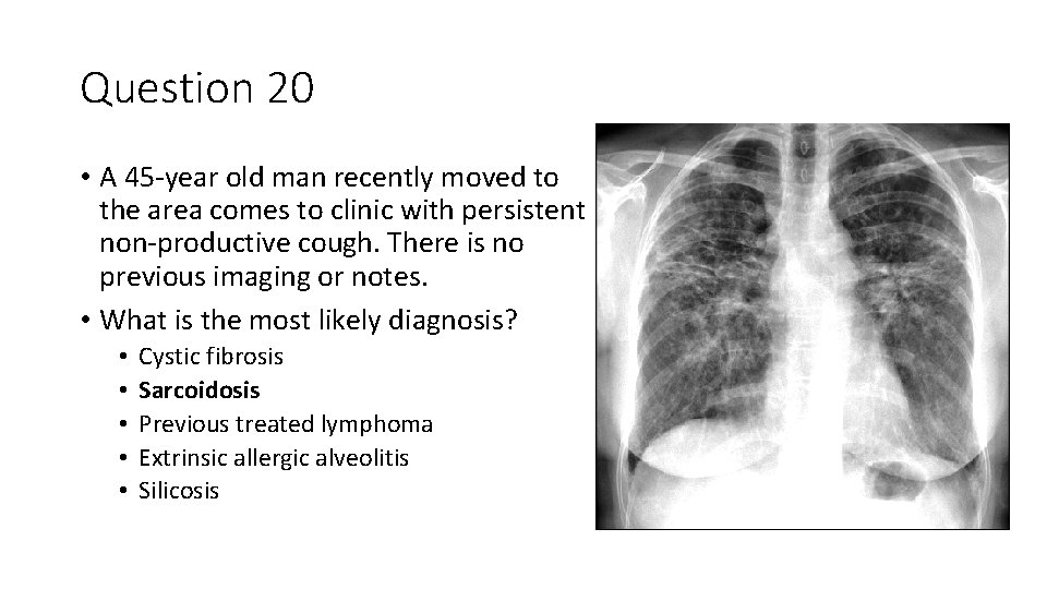 Question 20 • A 45 -year old man recently moved to the area comes