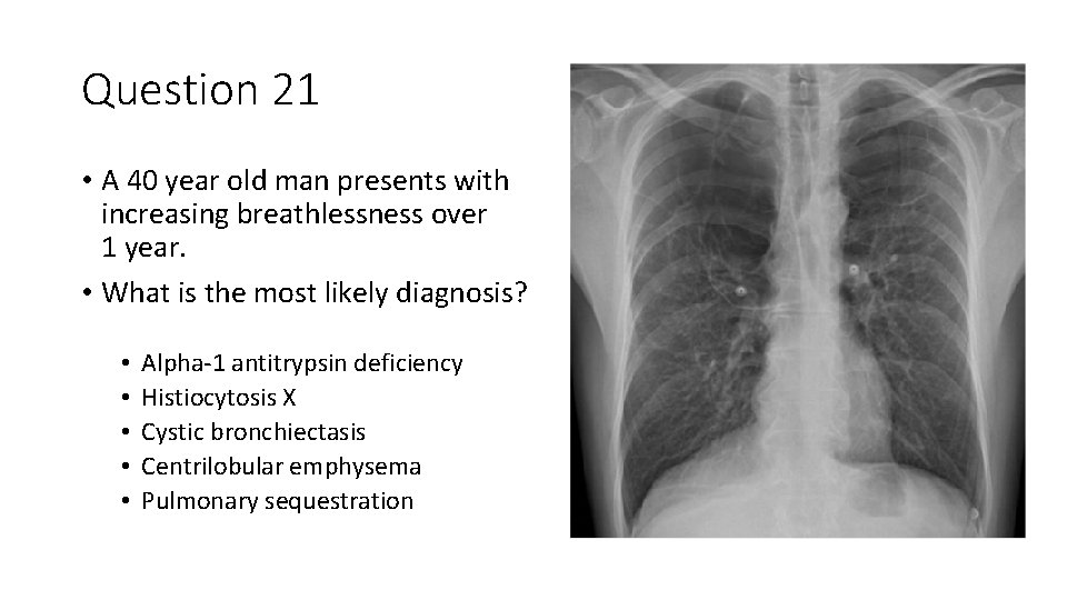 Question 21 • A 40 year old man presents with increasing breathlessness over 1