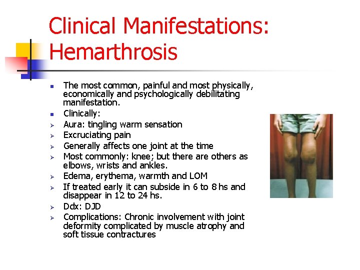 Clinical Manifestations: Hemarthrosis n n Ø Ø Ø Ø The most common, painful and
