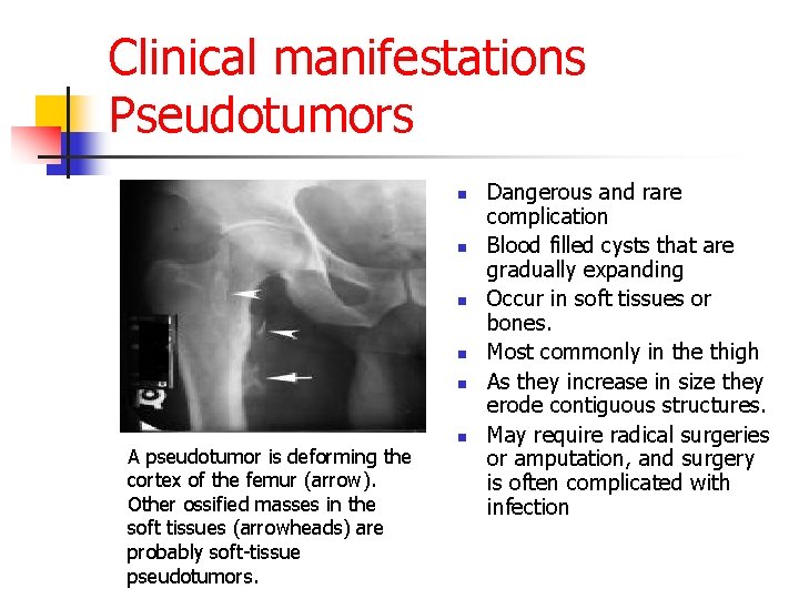 Clinical manifestations Pseudotumors n n n A pseudotumor is deforming the cortex of the
