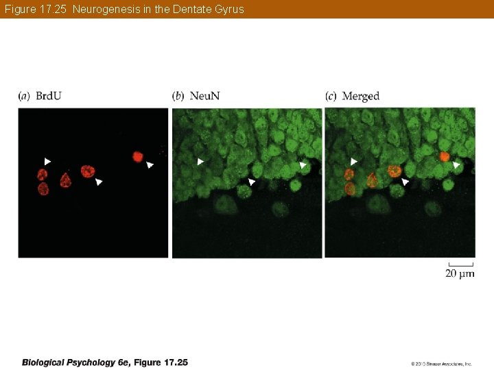 Figure 17. 25 Neurogenesis in the Dentate Gyrus 