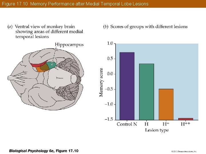 Figure 17. 10 Memory Performance after Medial Temporal Lobe Lesions 