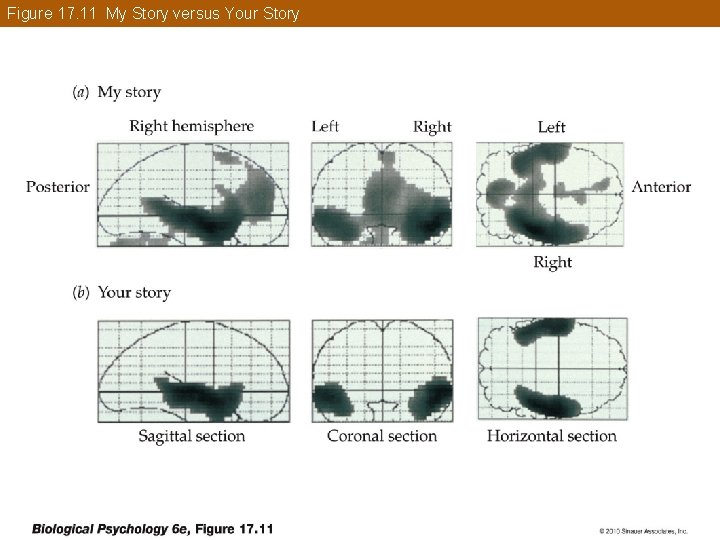 Figure 17. 11 My Story versus Your Story 