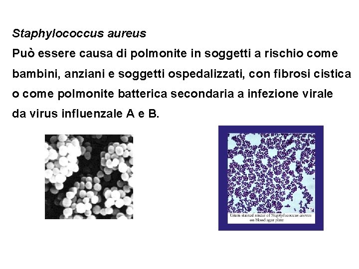Staphylococcus aureus Può essere causa di polmonite in soggetti a rischio come bambini, anziani