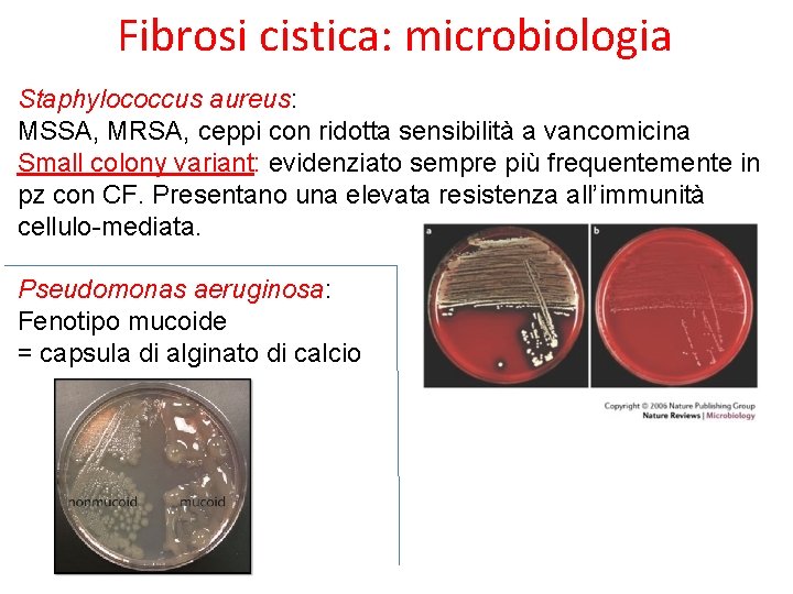 Fibrosi cistica: microbiologia Staphylococcus aureus: MSSA, MRSA, ceppi con ridotta sensibilità a vancomicina Small