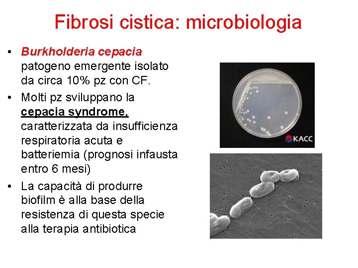 Fibrosi cistica: microbiologia • Burkholderia cepacia patogeno emergente isolato da circa 10% pz con