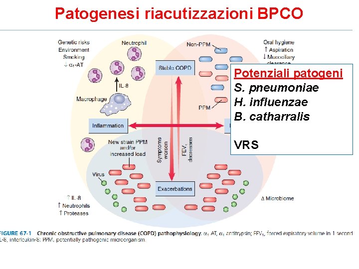 Patogenesi riacutizzazioni BPCO Potenziali patogeni S. pneumoniae H. influenzae B. catharralis VRS 