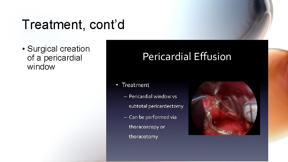 Treatment, cont’d • Surgical creation of a pericardial window Treatment, cont’d • Surgical creation of a pericardial window