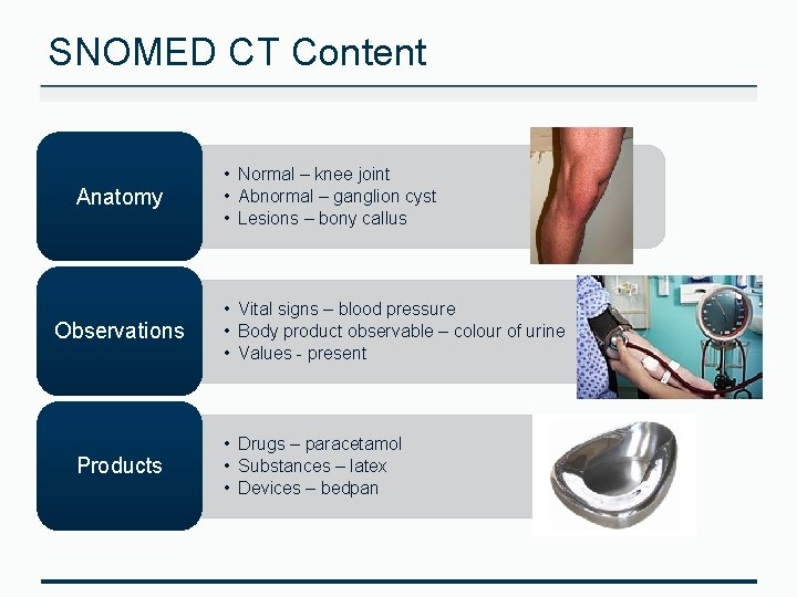 SNOMED CT Content Anatomy Observations Products • Normal – knee joint • Abnormal –