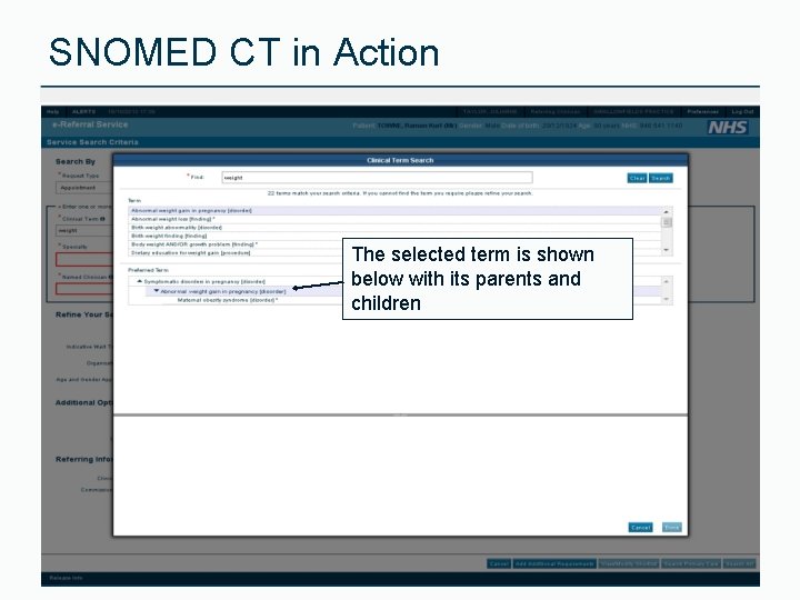 SNOMED CT in Action The selected term is shown below with its parents and