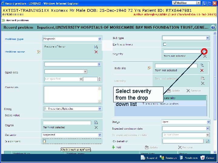Select severity from the drop down list 