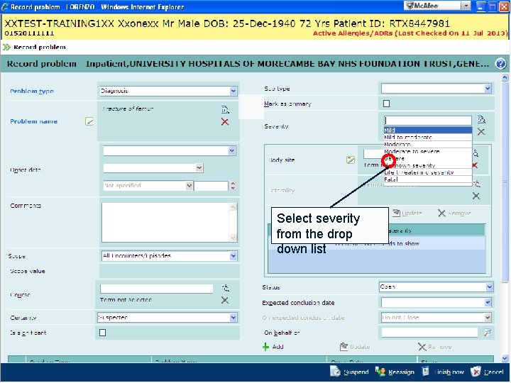 Select severity from the drop down list 