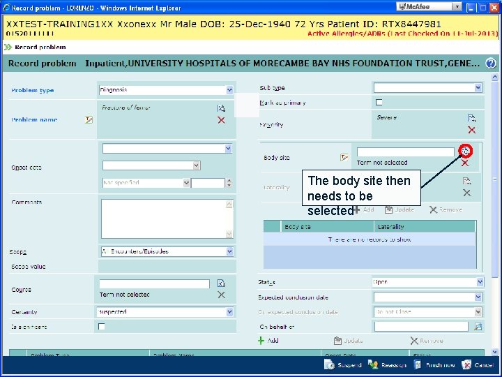 The body site then needs to be selected 