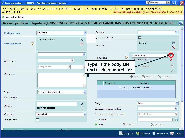 Type in the body site and click to search for it 