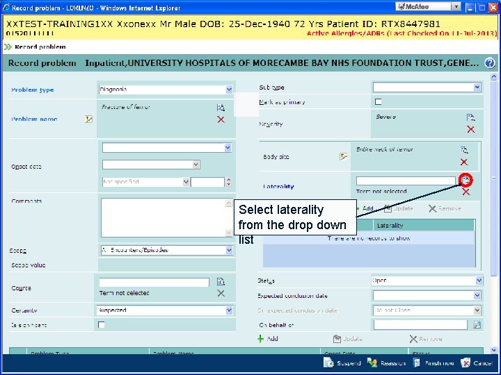 Select laterality from the drop down list 
