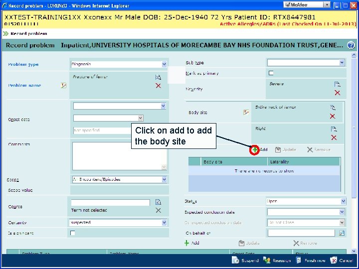 Click on add to add the body site 