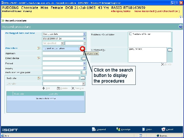 Click on the search button to display the procedures 