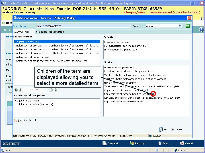 Children of the term are displayed allowing you to select a more detailed term
