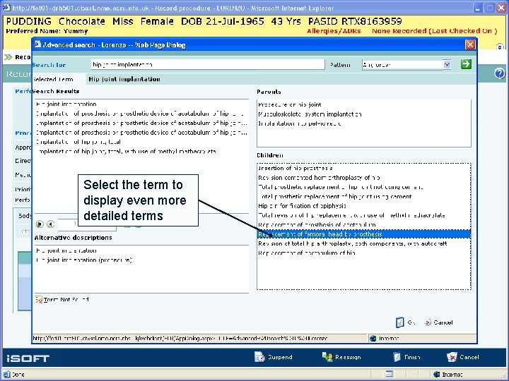 Select the term to display even more detailed terms 