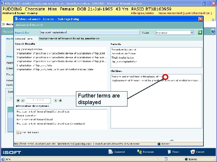 Further terms are displayed 