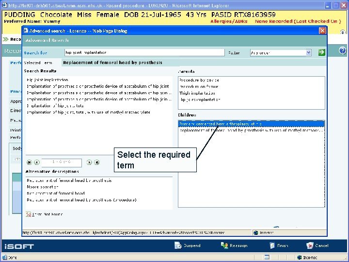 Select the required term 