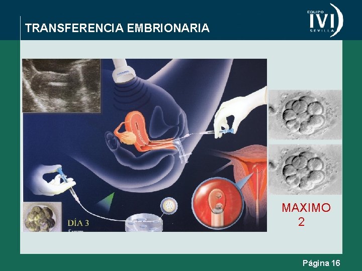 TRANSFERENCIA EMBRIONARIA MAXIMO 2 Página 16 