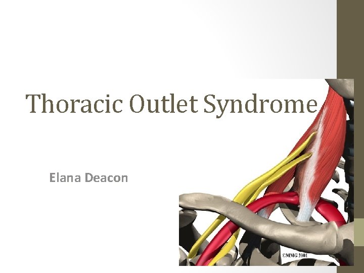 Thoracic Outlet Syndrome Elana Deacon 