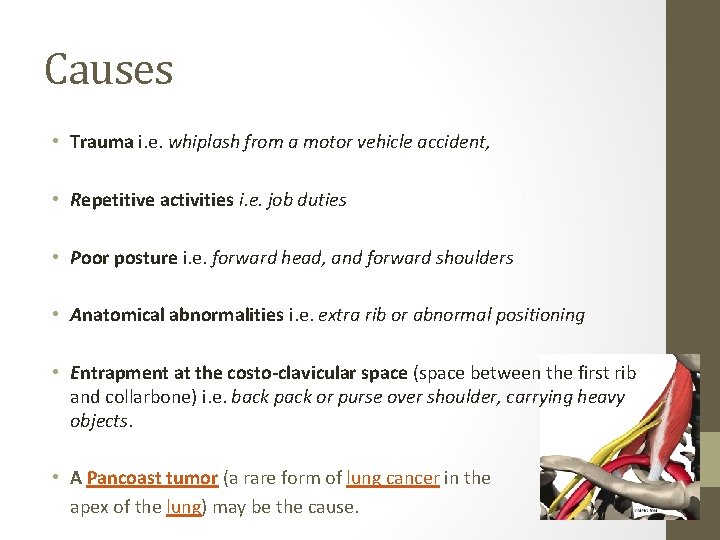 Causes • Trauma i. e. whiplash from a motor vehicle accident, • Repetitive activities