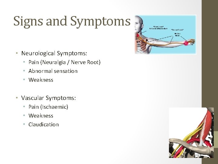 Signs and Symptoms • Neurological Symptoms: • Pain (Neuralgia / Nerve Root) • Abnormal