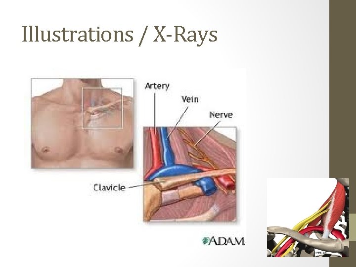 Illustrations / X-Rays 