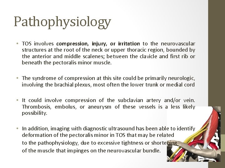 Pathophysiology • TOS involves compression, injury, or irritation to the neurovascular structures at the