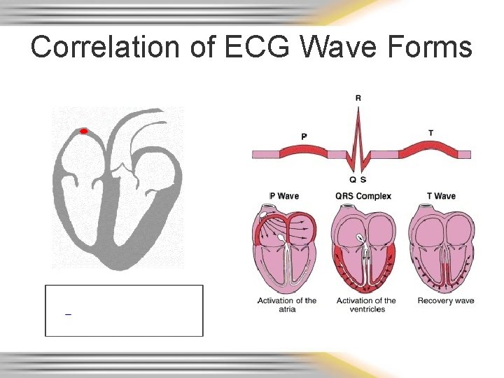 Correlation of ECG Wave Forms 