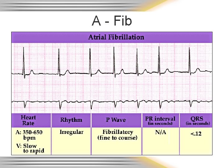 A - Fib 