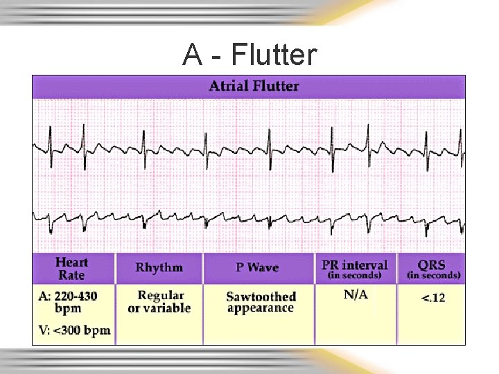 A - Flutter 