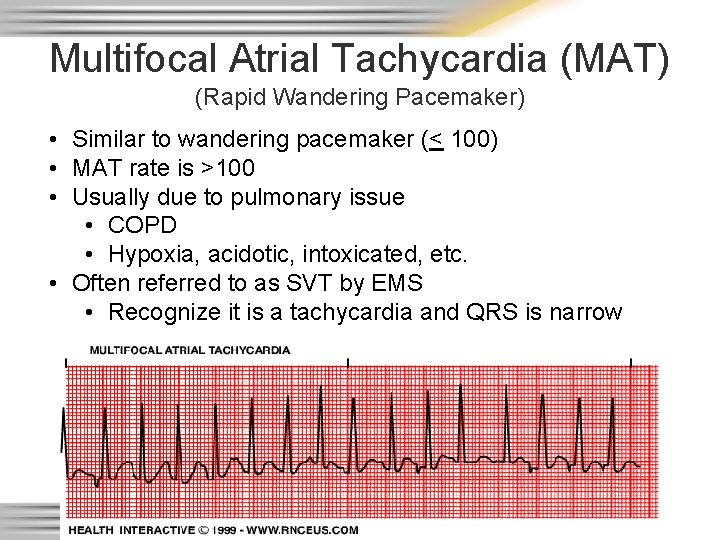 Multifocal Atrial Tachycardia (MAT) (Rapid Wandering Pacemaker) • Similar to wandering pacemaker (< 100)