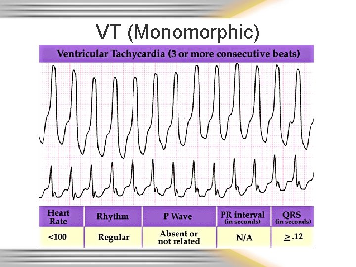 VT (Monomorphic) 