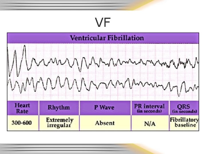 VF 