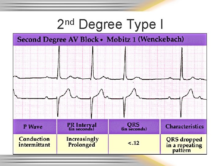 2 nd Degree Type I 