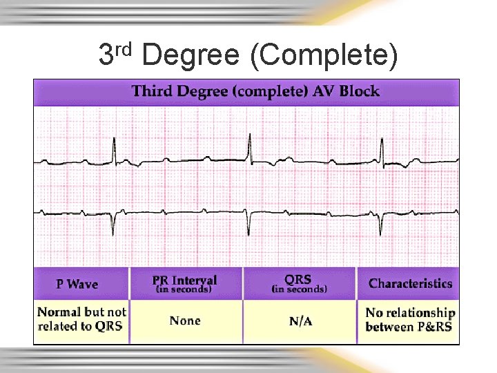 3 rd Degree (Complete) 