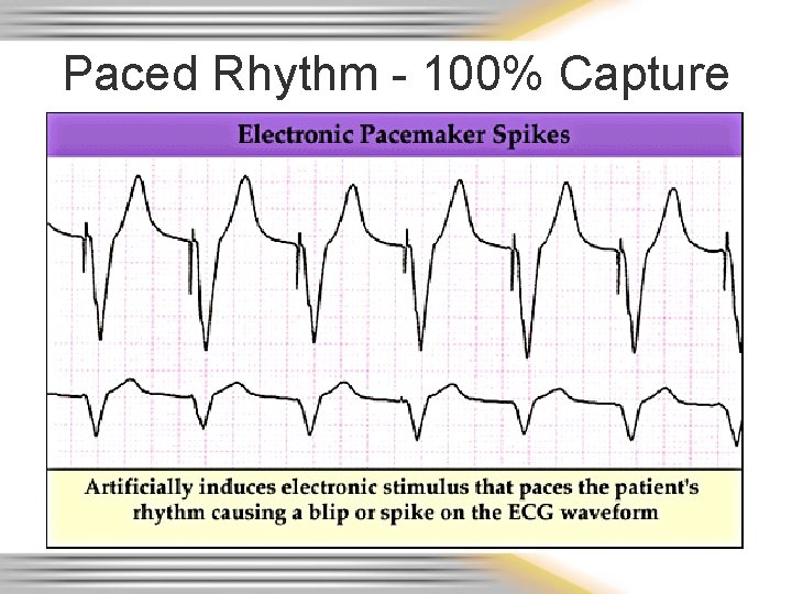 Paced Rhythm - 100% Capture 