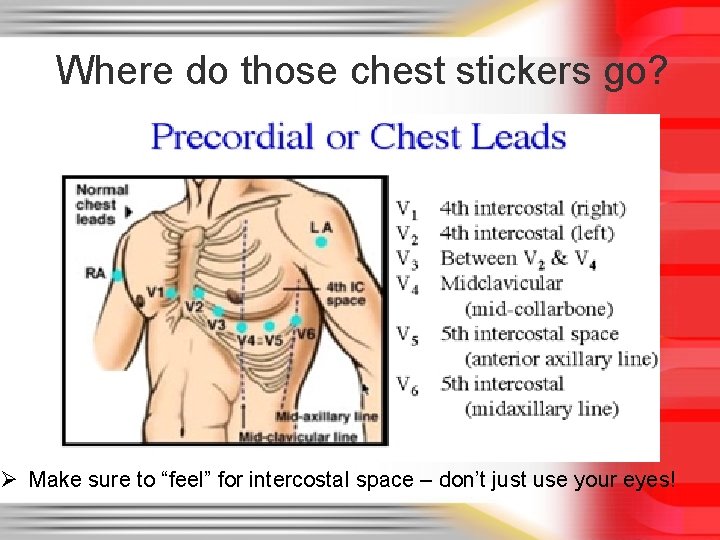 Where do those chest stickers go? Ø Make sure to “feel” for intercostal space