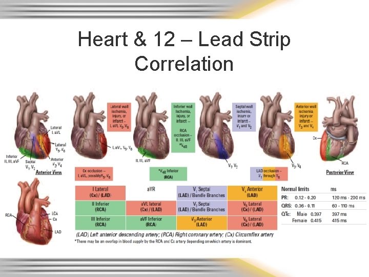 Heart & 12 – Lead Strip Correlation 