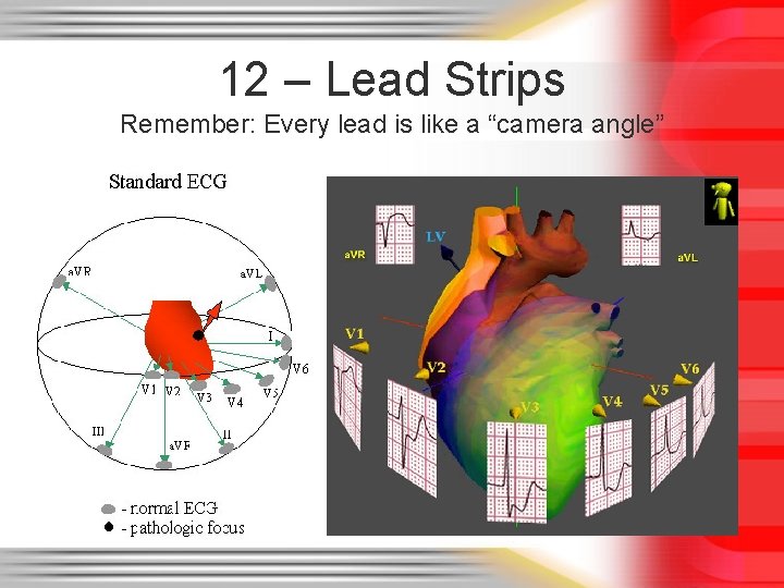 12 – Lead Strips Remember: Every lead is like a “camera angle” 