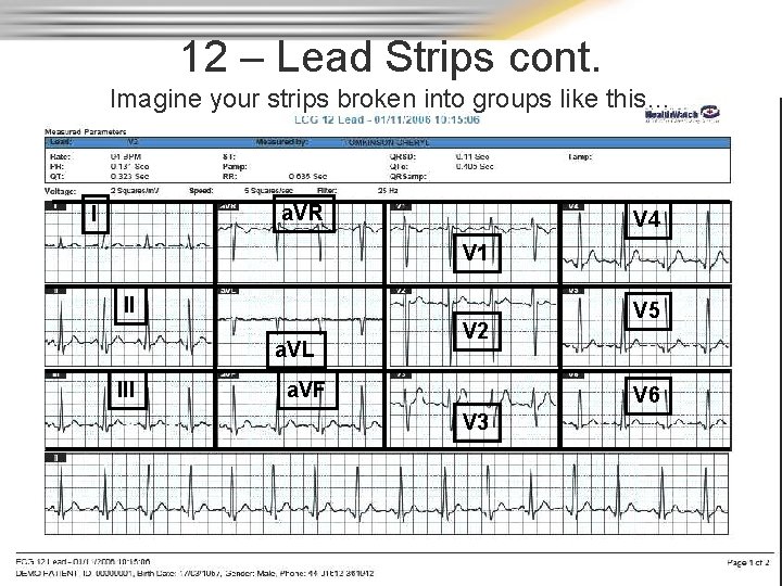 12 – Lead Strips cont. Imagine your strips broken into groups like this… a.