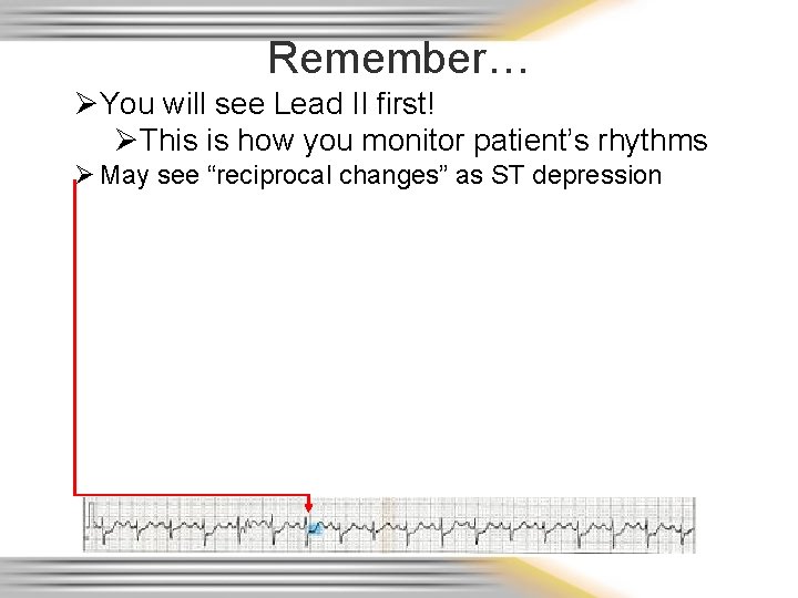 Remember… ØYou will see Lead II first! ØThis is how you monitor patient’s rhythms